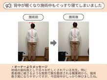 ピースフルポイント(Peaceful Point)/姿勢改善整体 before/After