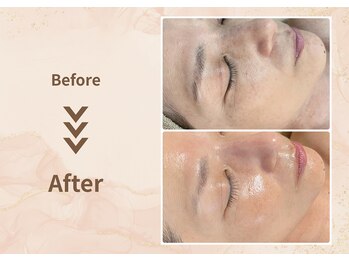 プラム(plum)/セルマン