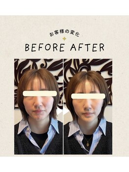 キサラ(Kisara)/エイジングショット