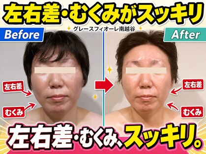 グレースフィオーレ 南越谷店(gracefiore)の写真