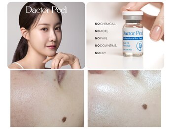 エスボーテ(sbeaute)の写真/肌質改善を目指す最新ピーリング