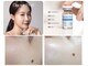 エスボーテ(sbeaute)の写真/肌質改善を目指す最新ピーリング