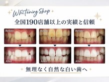 ホワイトニングショップ 津店の雰囲気（全国190店舗の実績と信頼｜着色・黄ばみ悩みに◎矯正中も大歓迎）