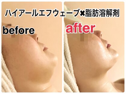 リュイール(LUIRE)の写真