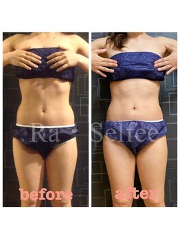 ラ セルフィー(Ra Selfee)/プロにお任せ！