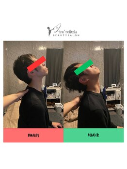 リノレリチア 心斎橋 新町店/肩こり首こり眼精にもオススメ