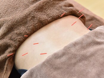 コウ 水戸(KOH)の写真/腰痛・頭痛・倦怠感…つらいお悩みに《やさしい鍼灸×全身整体》不調を根本から改善します！20時まで受付◎