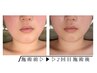 2ヶ月以内再来【小顔矯正＋ヘッド＋デコルテ＋背中 90分】