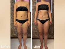 ワールドビューティー(World Beauty)/滝汗デトックス×強圧リンパ痩身