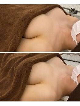 イリス 神田(iris)/下垂・離れ乳のお悩みにも◎