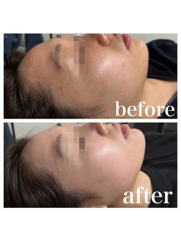 オリンピア 横浜(OLYMPIA)/