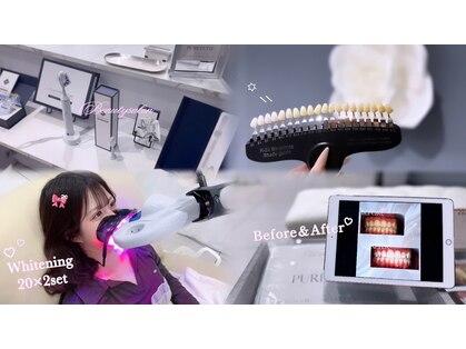ピュアティス(PURETETH)の写真