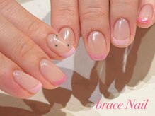 ブレスネイル(brace Nail)