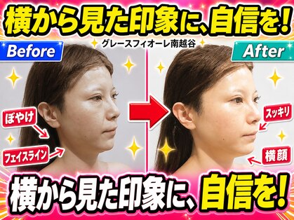 グレースフィオーレ 南越谷店(gracefiore)の写真