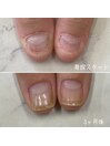 自爪育成3ヶ月コース