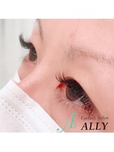 アリー(ALLY)/