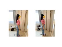 ララ(LALA)/1日で姿勢が良くなりました