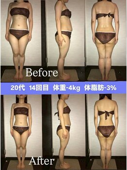 シェイプ 浜松本店/気になる下腹部も撃退