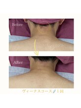 エキュロ 敦賀店(equro)/ヴィーナスコース☆ 1回の変化