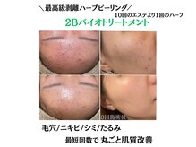 モンクラッシー(Mon classy)