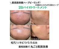 モンクラッシー(Mon classy)