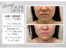 サロンドエリ ラクロワジエール(Salon d’ERI la Croisiere)/【小顔・くすみ・透明感・毛穴】