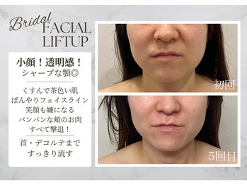 サロンドエリ ラクロワジエール(Salon d’ERI la Croisiere)/【小顔・くすみ・透明感・毛穴】