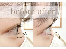 モア(Moi)/上下まつげパーマ