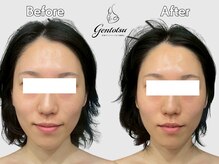 ゲントツ 新宿の雰囲気（卓越した技術[小顔/毛穴/フェイシャル］）