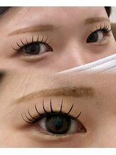 エピコ(epico)/バインドロック