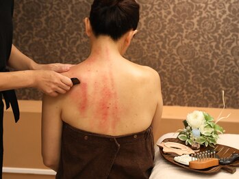 ソルーナ(So-Luna)/ボディかっさマッサージ