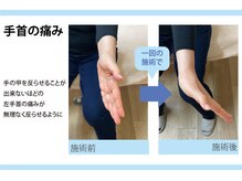 セルフケア整体 新宿店/実際のお客様◆1来店 手首の痛み