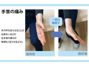 セルフケア整体 新宿店/実際のお客様◆1来店 手首の痛み