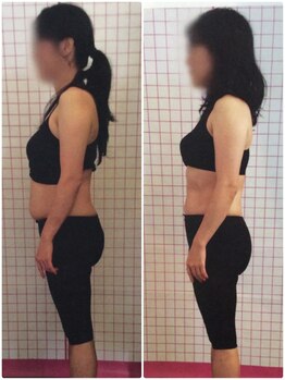 みのお骨盤リフォーム整骨院/楽トレ　before after