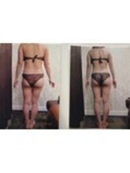 パーフェクトボディプレミアム 渋谷店(PERFECT BODY PREMIUM)/お客様 ビフォーアフター(16)