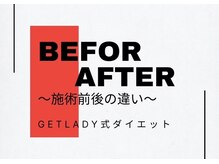 ゲットレディー 本店(GetLady)/