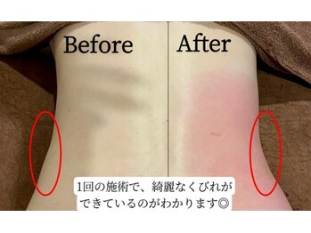 マナリンパ(Mana)/ボディーラインを整える