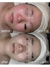 フロル(FLOR)/FLOR【根本改善専門店】