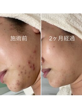 シェノン 赤坂大濠店/