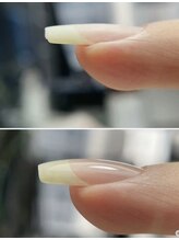 爪の状態に合わせて、フィルイン施術も行っています。
