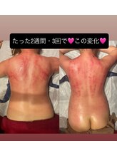 フェリーチェ(felice)/セル分解ビフォーアフター