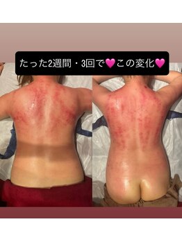 フェリーチェ(felice)/セル分解ビフォーアフター