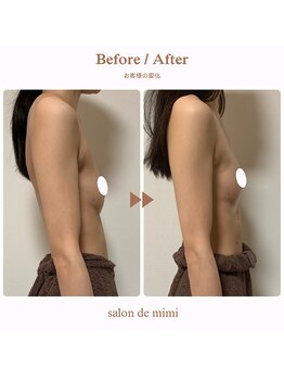 サロン ド ミミ(salon de mimi)/バストアップBeforeAfter