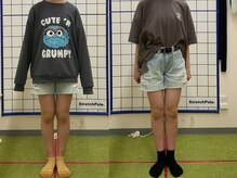 やまかわ整体院/変化実感！国家資格者のO脚矯正