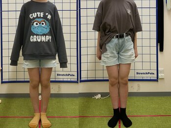 やまかわ整体院/変化実感！国家資格者のO脚矯正
