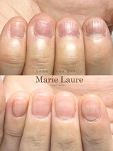 マリーロール 梅田店(Marie Laure)/自爪育成/深爪矯正/ネイルケア