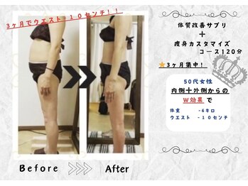 サロンデュ ひゃーく(Salon du ひゃーく)/痩せやすい体へ！見た目激変！