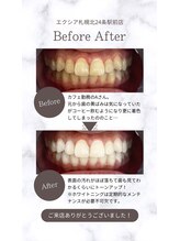 エクシアホワイト 平岸駅前店/