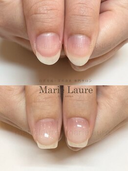 マリーロール 梅田店(Marie Laure)/深爪矯正/自爪育成/ネイルケア