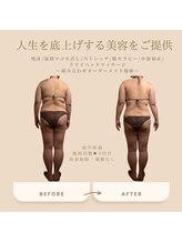 マリーズウィル(MARY's WILL)/背中が変わる！